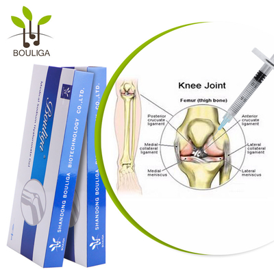 Suntikan Lutut Asam Hyaluronic Non Bedah Perawatan 1ml Untuk Osteoarthritis